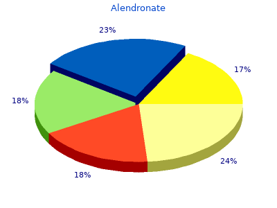 purchase alendronate 35mg with mastercard