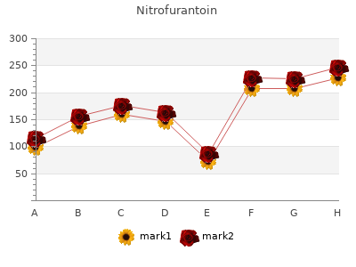 buy 50 mg nitrofurantoin with mastercard